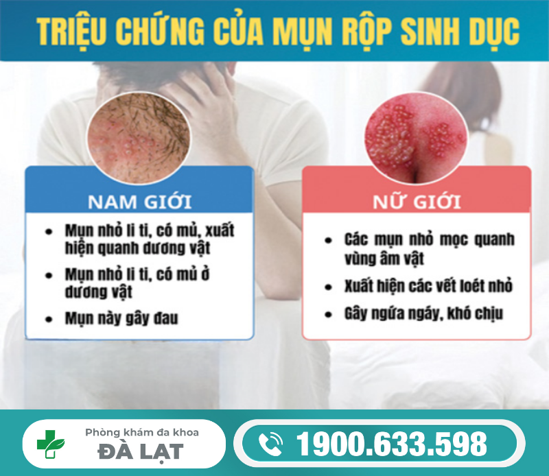 Hình ảnh minh họa